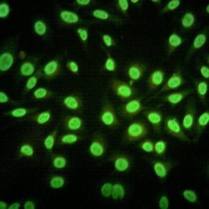 Inmunofluorescencia